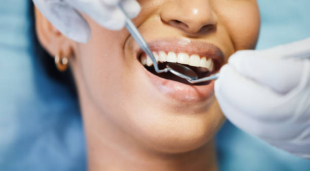 Best Knocked-Out Tooth Emergency  in Fennimore, WI